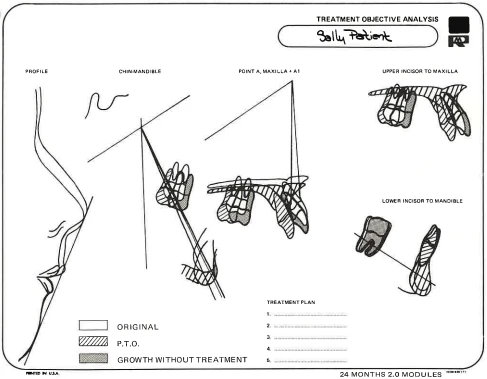 Manual Illustration